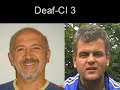 deaf-CI 3