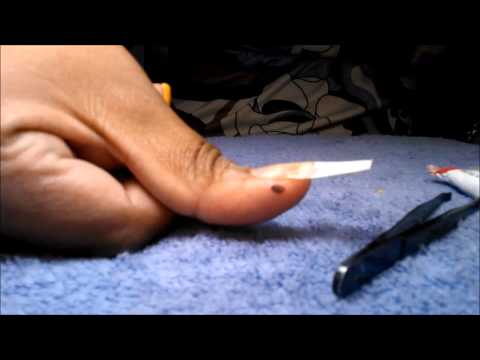 how to repair a broken nail