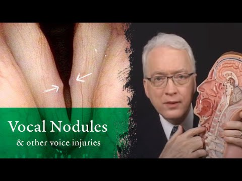 how to cure vocal nodules