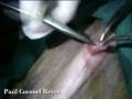 Laparoscopic Approach in Canine. Open Technique