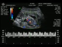Bebit@ a las 14+2 semanas :)!