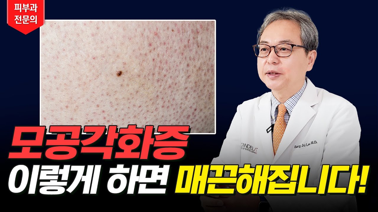 연세스타피부과 TV