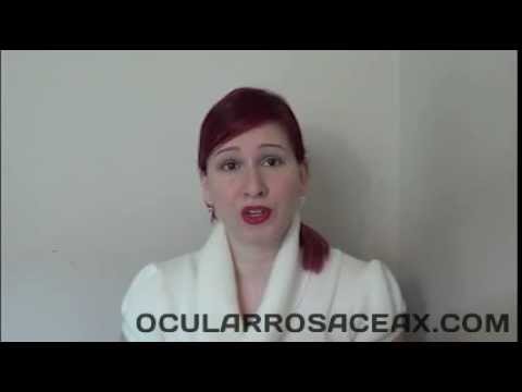 how to treat ocular rosacea