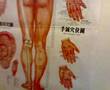 Why Accupuncture isn't mainstream yet
