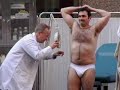 SKIN CANCER SCREENING
