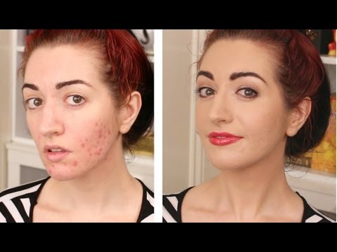 how to cover acne by makeup