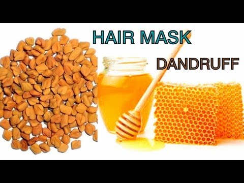 how to relieve dandruff itch