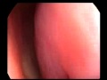 Inside the nose