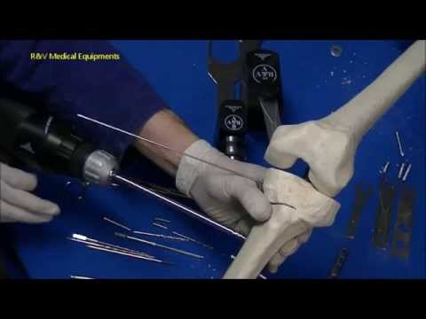 osteosynthesis screw driver osteosynthesis screw driver
