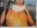 Pepper Sprayed To Death In Jail