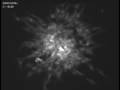 Glioma Invasion