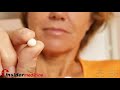 Insidermedicine in 60 - March 4, 2008  Procedures and Therapies Genetic Testing