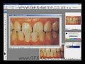 Teeth Whitening Photoshop CS3 Teeth Whitening Photoshop CS3