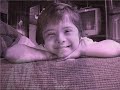 Down syndrome:&nbsp;S�ndrome de Down: Gigantes Chiquitos