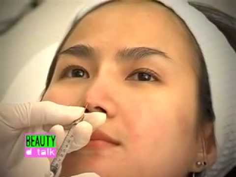 ฉีดจมูก - โชว์การเสริมจมูกแบบฉีด Filler + เสริมคางด้วย Filler, Botox ปรับรูปหน้าด้วย Dysport จากประเทศอังกฤษ และ...