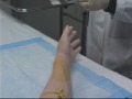 Peripheral Venous Access