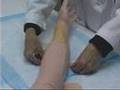 Peripheral Venous Access