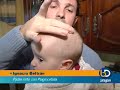 Reportaje sobre plagiocefalia Reportaje sobre plagiocefalia