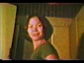 amputee woman lhd one crutch