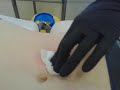 micro-dermal