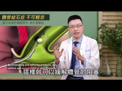 膽管結石不可輕忽