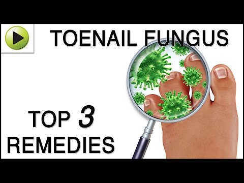 how to eliminate toenail fungus naturally