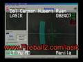 LASIK Surgery - a real-time look at LASIK eye laser surgery