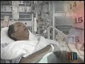 Deep brain stimulation for Parkinson\ Deep brain stimulation for Parkinson\