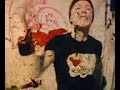 The Flatliners - \"Broken Bones\"