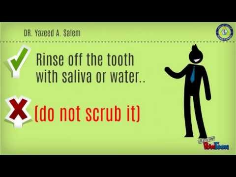 how to treat avulsed tooth