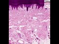 Shotgun Histology Thick Skin