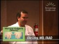 Dermatology of Seattle presents: Your guide to Warts (Verruca Vulgaris)