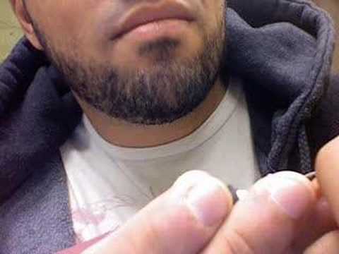 how to drain infected hangnail