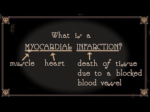 how to treat myocardial infarction