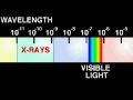 X RAYS