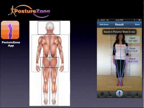 how to assess posture