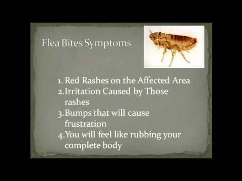 how to relieve flea bites on dogs