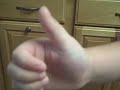 Dubious Thumb Wrestling Victory Dubious Thumb Wrestling Victory