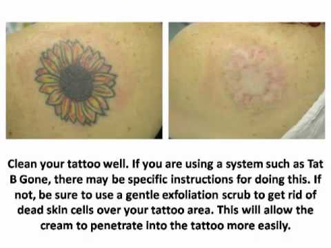how to remove flash tattoos
