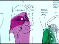 How to Find Trigger Points : Trigger Points: Piriformis How to Find Trigger Points : Trigger Points: Piriformis