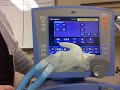 ventilator type & modes part I ventilator type & modes part I