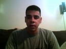 Upper Jaw Surgery 4 (The Day After) Upper Jaw Surgery 4 (The Day After)