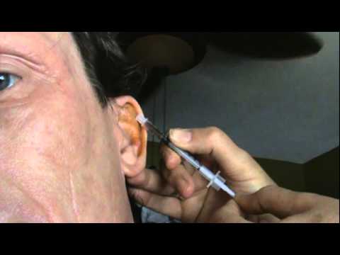 how to drain fluid from ear naturally