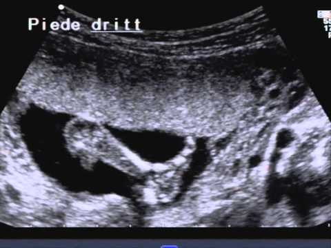 Diciassettesima settimana