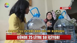 Günde 25 litre su içiyor!