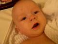 Linden's Laryngomalacia - 3 Months