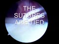 Arthroscopic Rotator Cuff Repair Arthroscopic Rotator Cuff Repair