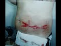 EGYPT HORROR- ALGERIAN TORTURED IN EGYPT جزائري عذب في مصرائيل .flv