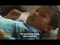 The US bomb legacy in Laos