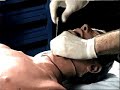 Cricothyroidotomy